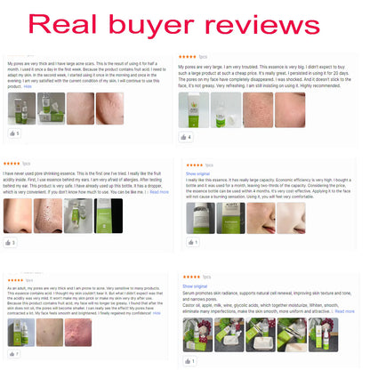 Acidity Pore Shrink Face Serum Remove Blackheads Acne Oil Control Repair Essence Moisturizing Nourish Pores Firming Facial Care