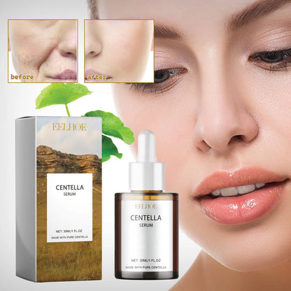 Korean Centella Asiatica Face Serum Shrink Pores Smoothing Rejuvenation Skin Brighten Whitening Cream Facial Moisturizing 30 ml