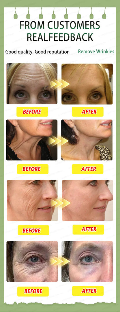 wrinkles disappear become beautiful now