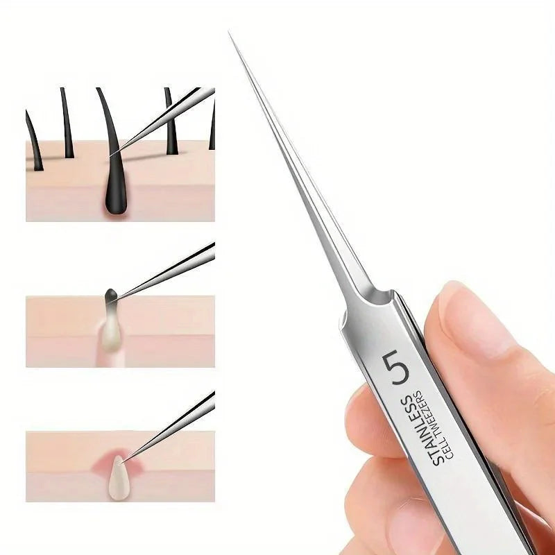 Extra Fine Cellular Acne Blackhead Tweezers - Facial Beauty Remove Acne Needle Tools for Skin Care,Blemish and Whitehead Removal