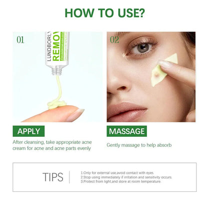 Natural Herbal Face Cream 20g Acne Cream with Salicylic Acid Oil Control Moisturizing Fading Acne Marks Gentle Non Irritating