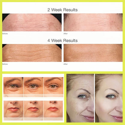 Retinol Shot Tightening Booster For Firm Skin Face Serum Eye Cream Moisturizing Anti Aging Wrinkles Dark Circles Puffiness Care