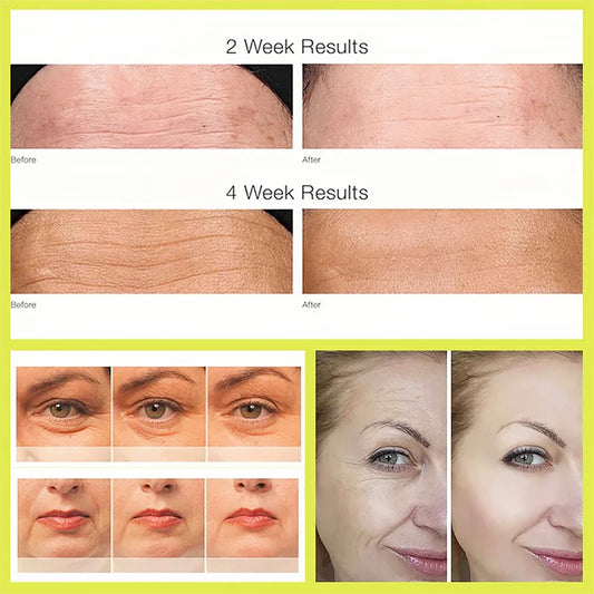 Retinol Shot Tightening Booster For Firm Skin Face Serum Eye Cream Moisturizing Anti Aging Wrinkles Dark Circles Puffiness Care