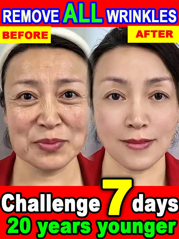 Wrinkles disappear,20 years younger