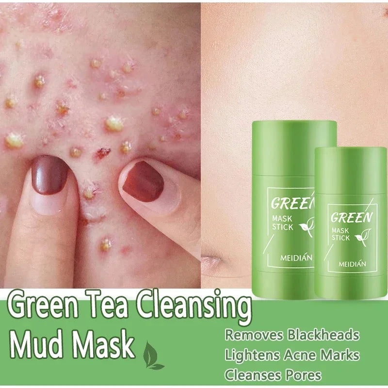 Green Tea Remove Blackhead Solid Mask Dispel Acne Blemish Cleansing Stick Mask Shrink Pores Tighten Whitening Repair Skin Care