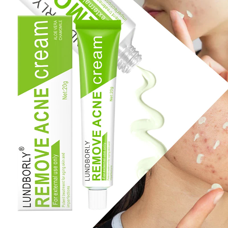 LUNDBORLY Acne Care Cream with Natural Herbal Extracts Helps Soothe Skin Improve Skin Texture and Keep Skin Smooth and Radiant
