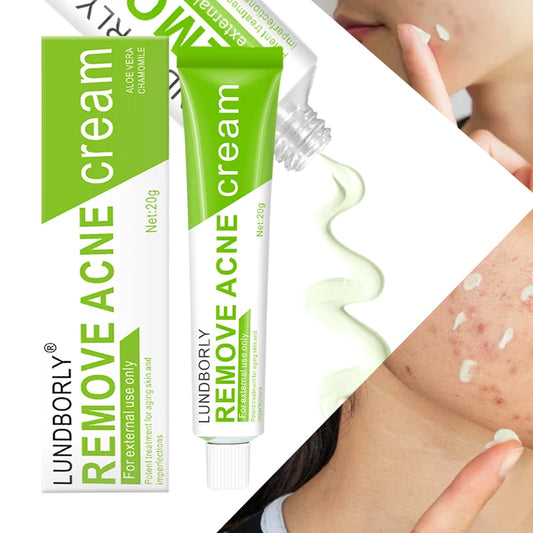 LUNDBORLY Acne Care Cream with Natural Herbal Extracts Helps Soothe Skin Improve Skin Texture and Keep Skin Smooth and Radiant