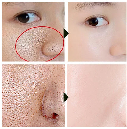 Acidity Pore Shrink Face Serum Remove Blackheads Acne Oil Control Repair Essence Moisturizing Nourish Pores Firming Facial Care