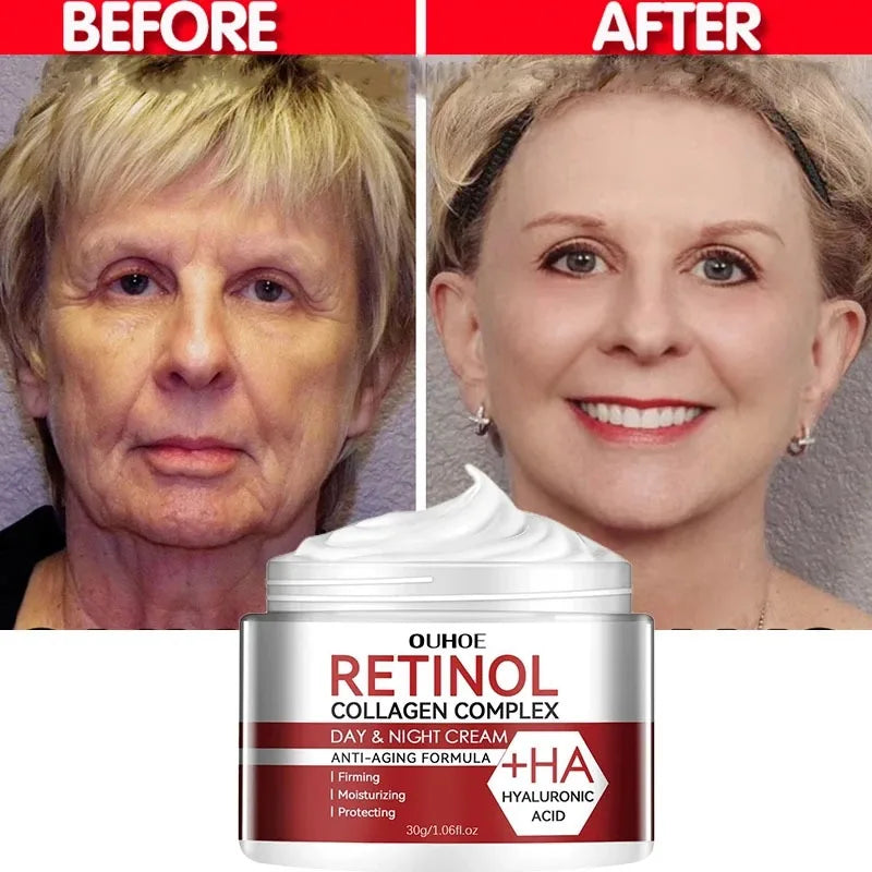 Retinol Wrinkle Removing Cream Anti Aging Firming Lifting Fade Fine Lines Moisturizing Brightening Skin Care Korean Cosmetics