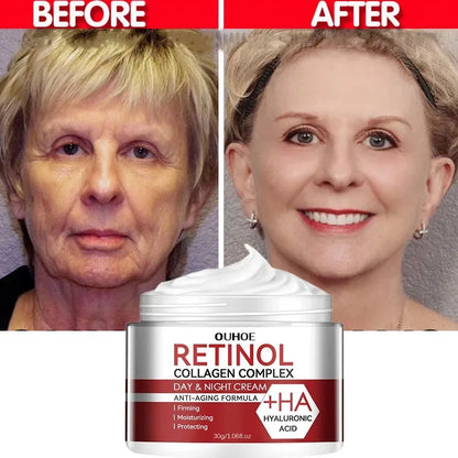 Retinol Wrinkle Removing Cream Anti Aging Firming Lifting Fade Fine Lines Moisturizing Brightening Skin Care Korean Cosmetics