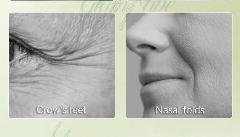 Wrinkles disappear permanently