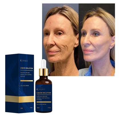 Niacinamide Wrinkle Remover Serum Firming Lifting Face Care Anti-Aging Fade Fine Lines Smooth Skin Beauty Facial Essence Liquid