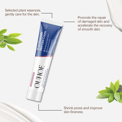 Pimple Acne Treatment Face Cream Nourish Balance Oil Control Refreshing Repairing Pimple Remover Acne Removing Cleansing Cream