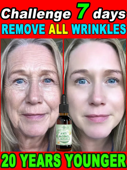 wrinkles disappear become beautiful now