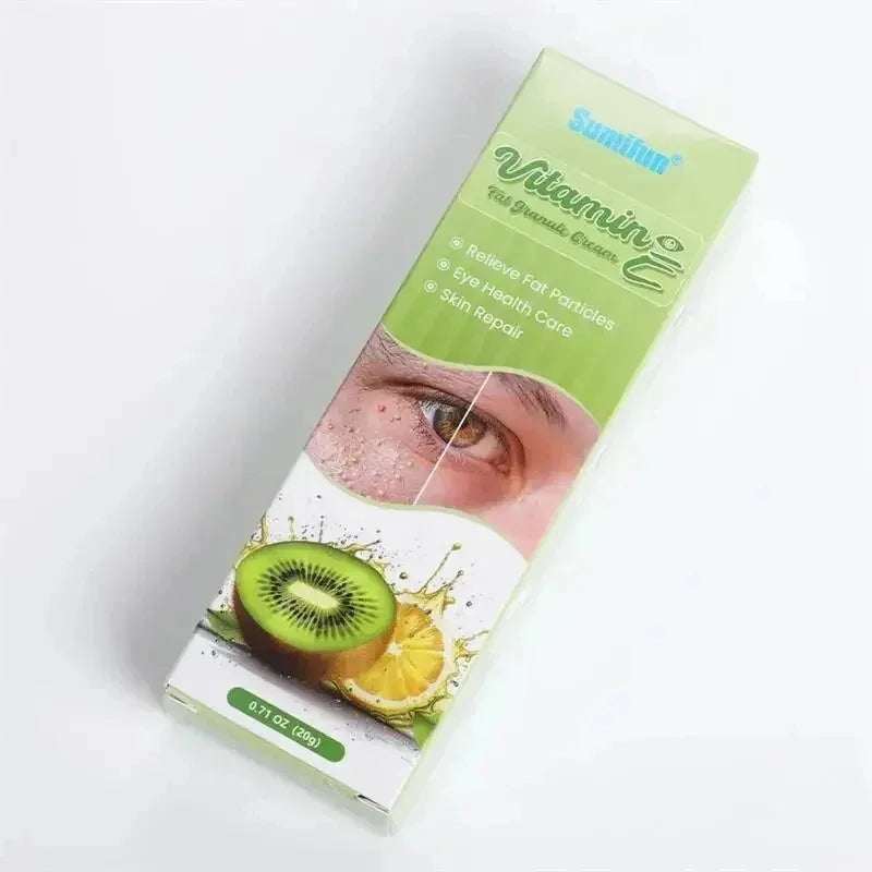 Fat Granules Remover Eye Cream Effective Remove Fat Granules Puffiness Anti-Particles Milia Remover Product Repair Eye Skin Care