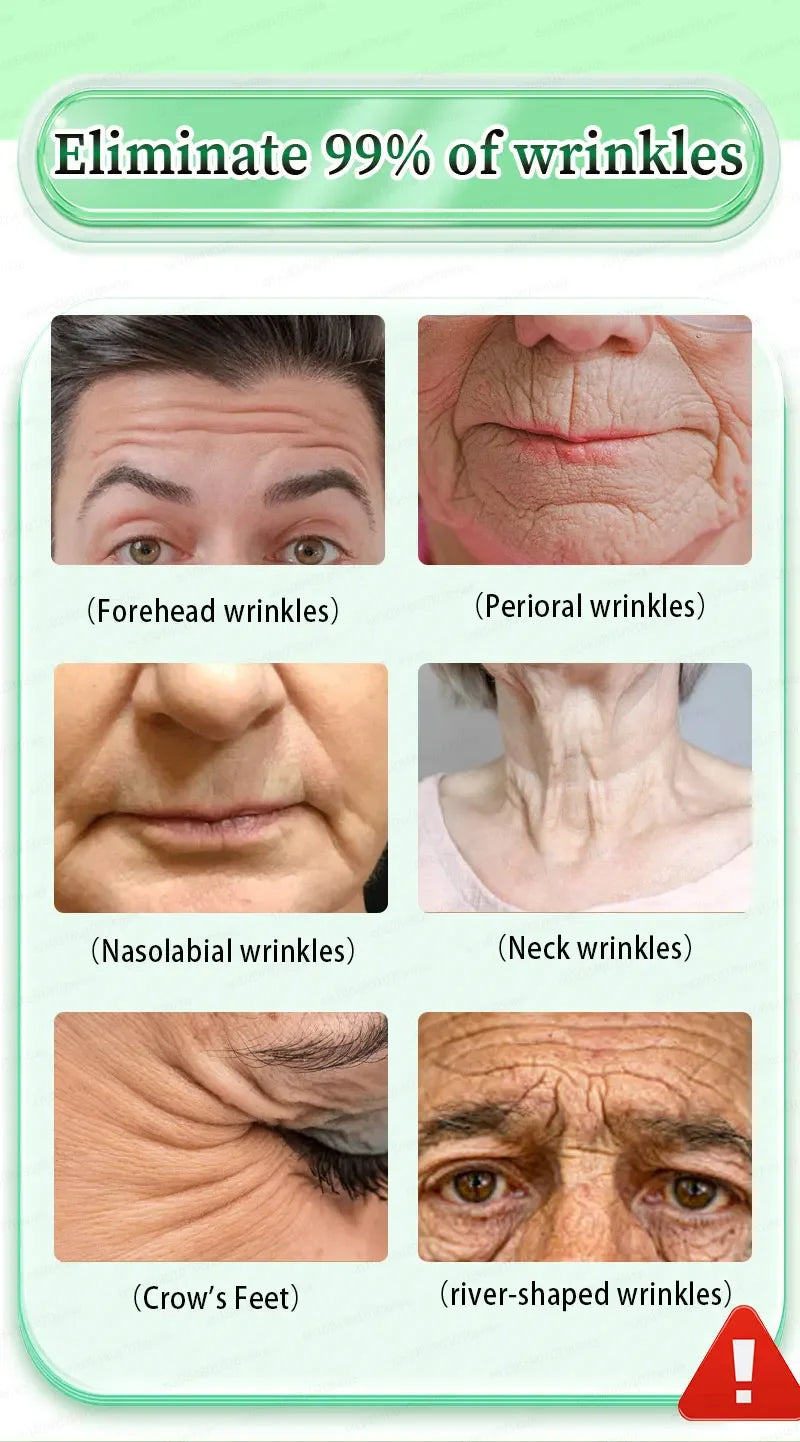 Wrinkles disappear,20 years younger