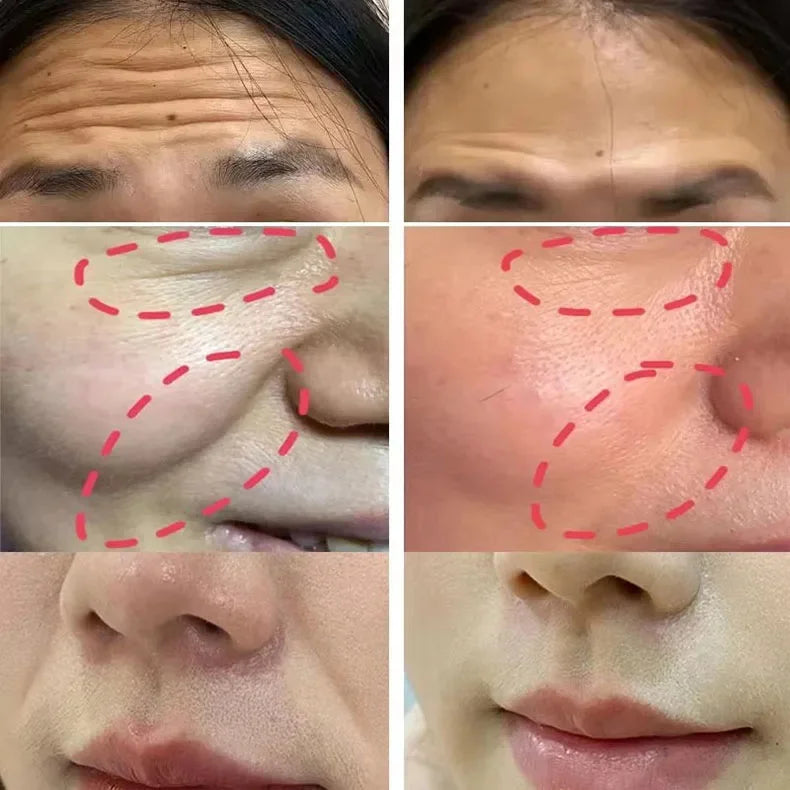 Instant Wrinkle Removal Multi Bounce Balm Facial Tightening Moisturizing Korean Anti-Wrinkle Balm Stick Cream Skin Care Products