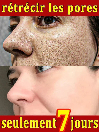 Salicylic Acid Pore Shrinking Cream Eliminate Large Pores Serum Remove Blackhead Acne Repairing Tightening Skin Care Cosmetics