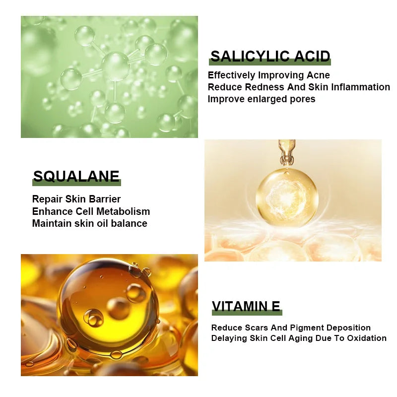 Anti-Acne Face Serum Salicylic Acid Acne Removing Essence Squalane Vitamin E Moisturizing Brightening Korean Skincare Products