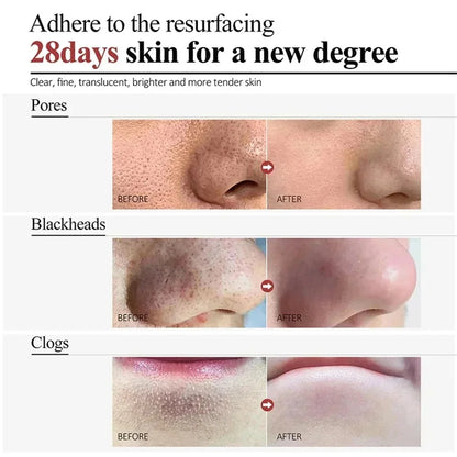 Salicylic Acid Pore Shrinking Cream Reduce Large Pore Tighten Refining Face Repair Rough Dull Pore Brighten Moisturize Skin Care