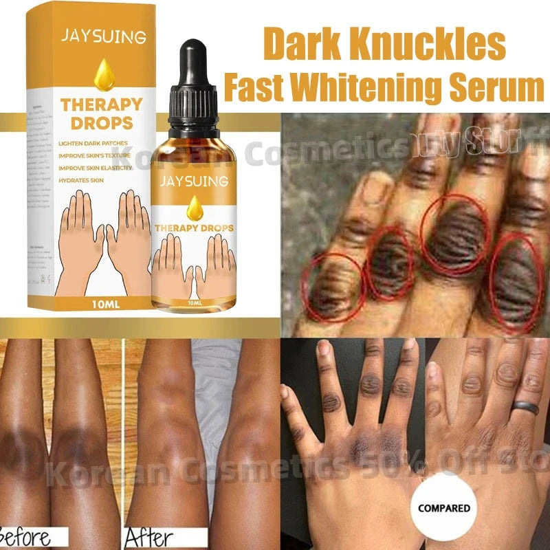 Dark Knuckles Fast Brighten Serum Elbows Hands Knee Armpits Brightening Serum Clarify Black Skin Lighten Stains Remover Essence