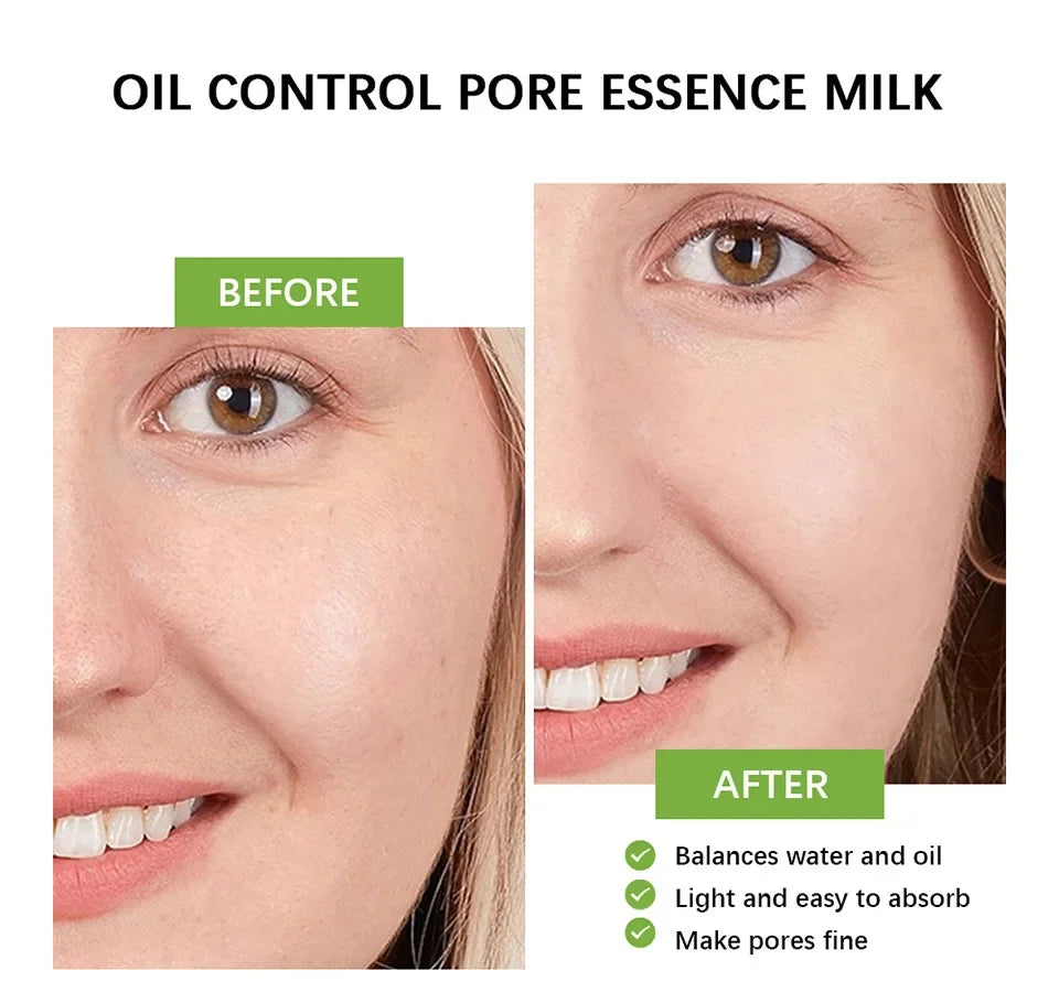 Salicylic Acid Pore Shrinking Cream Reduce Large Pore Tighten Refining Face Repair Rough Dull Pore Brighten Moisturize Skin Care
