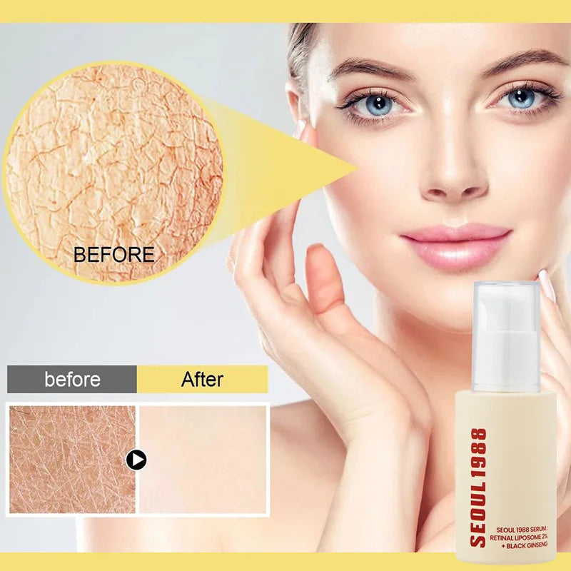 Seoul 1988 100ml Retinal Serum Brand Ginseng Eye Cream Closed Comedones Brighten Face Sunscreen Moisturize Korean Care Essence