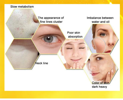 Lemon VC Facial Serum Brightens Skin Tone Fades Acne Marks Evens Complexion 50x Vitamin C Whitening Essence for Radiant Glow