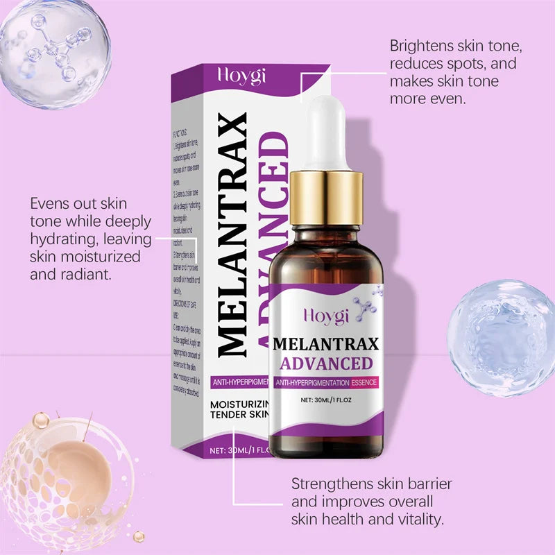 Dark Spots Remover Whitening Serum Face Freckle Melanin Correcting Anti Pigmentation Brighten Beauty Korean Day Night Skin Care