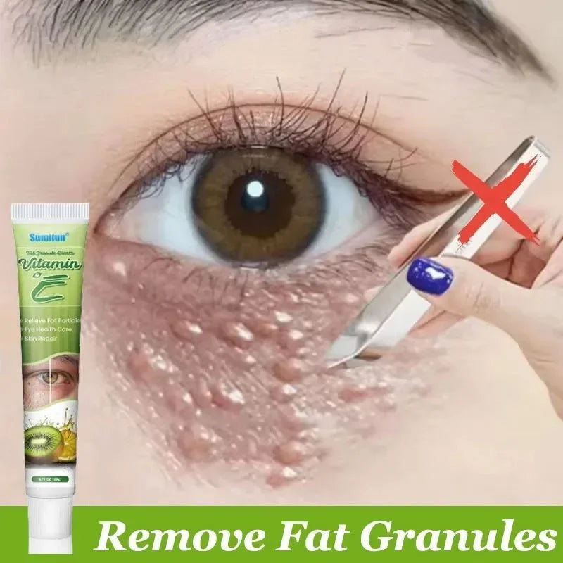 Fat Granules Remover Eye Cream Skin Care Products