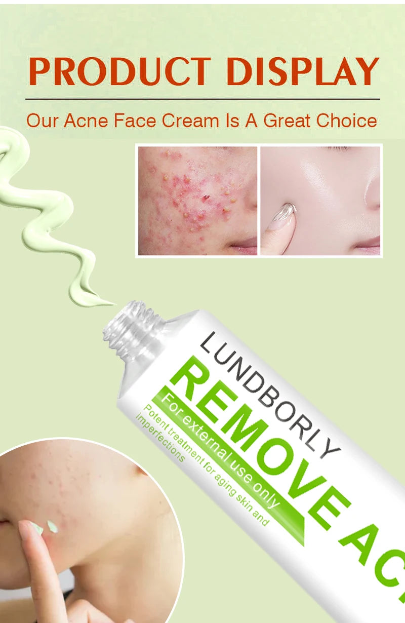 LUNDBORLY Acne Care Cream with Natural Herbal Extracts Helps Soothe Skin Improve Skin Texture and Keep Skin Smooth and Radiant