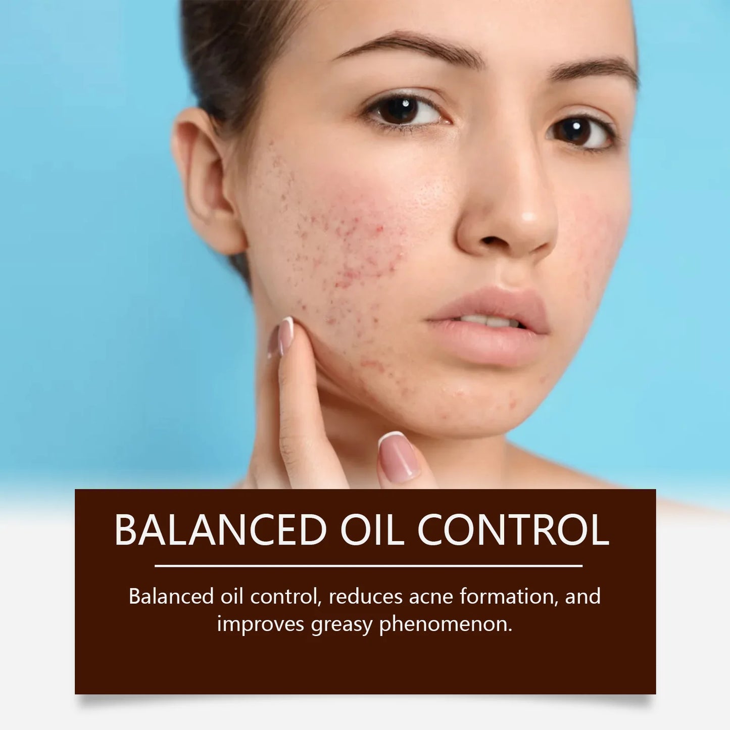 Pimple Acne Treatment Face Cream Nourish Balance Oil Control Refreshing Repairing Pimple Remover Acne Removing Cleansing Cream