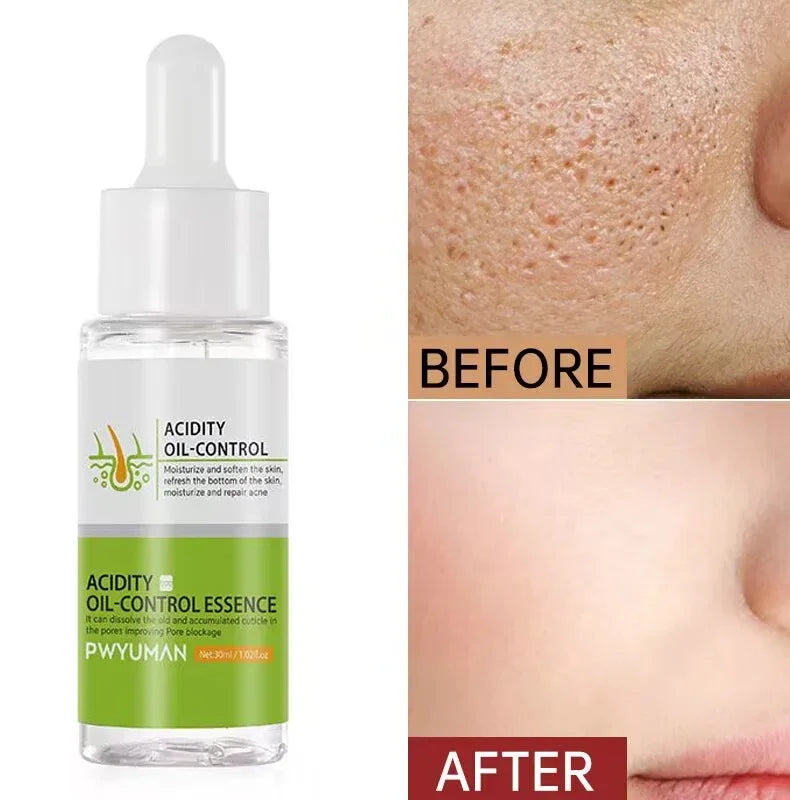Acidity Pore Shrink Face Serum Remove Blackheads Acne Oil Control Repair Essence Moisturizing Nourish Pores Firming Facial Care