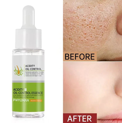 Acidity Pore Shrink Face Serum Remove Blackheads Acne Oil Control Repair Essence Moisturizing Nourish Pores Firming Facial Care
