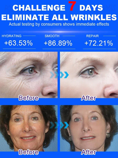 wrinkles disappeared