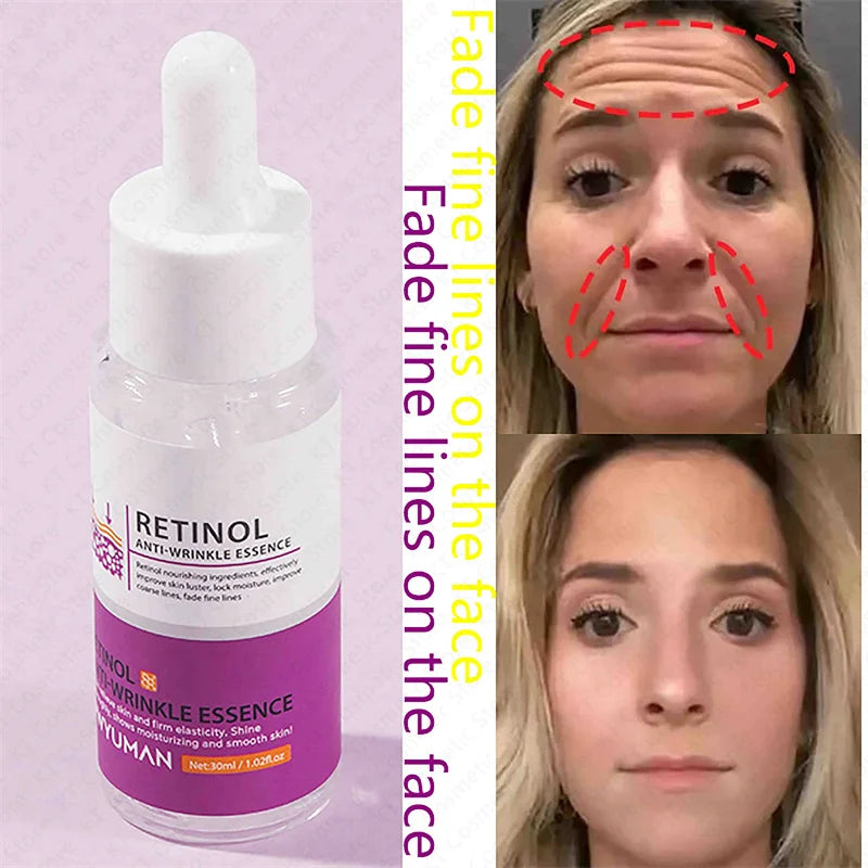 Retinol Against Wrinkles Serum Remove Wrinkle Firming Fade Fine Lines Anti Aging Improve Laugh Line Moisturizing Skin Care Korea