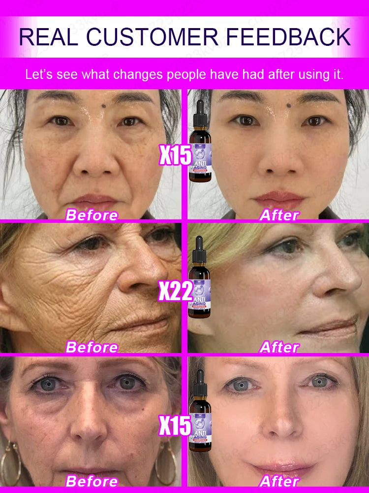 No wrinkles, 20 years younger