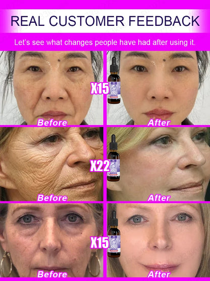 No wrinkles, 20 years younger