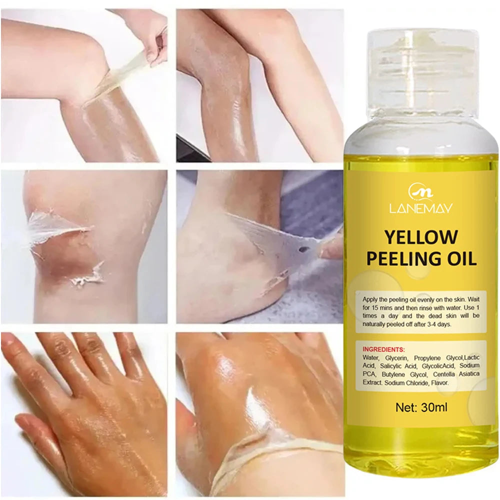 Strong Yellow Peeling Oil Bleach Dark Skin Whiten Lotion Lighten Body Elbow Knee Hand Exfoliate Dead Skin Nourish Even Skin Tone
