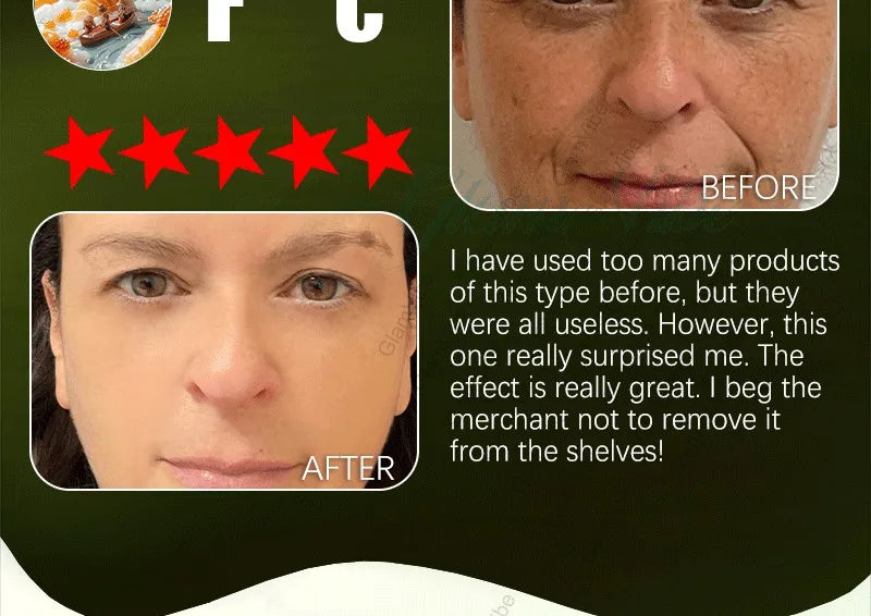 Wrinkles disappear permanently