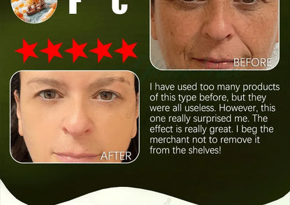 Wrinkles disappear permanently