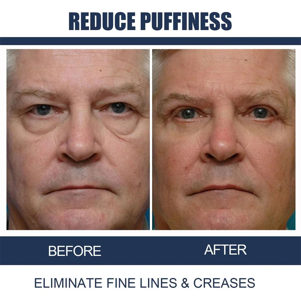 Instant Eye Bag Remove Eye Cream Anti Fat Particles Dark Circles Puffiness Fade Fine Lines Lift Brighten Korean Beauty Eye Care