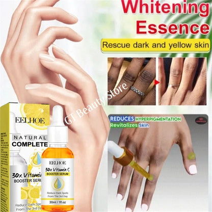 Dark Knuckles Fast Brighten Serum Elbows Hand Knuckle Brightening Serum Knee Black Skin Quickly Lighten Stains Remover Essence