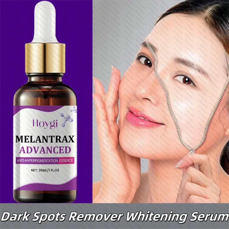 Dark Spots Remover Whitening Serum Face Freckle Melanin Correcting Anti Pigmentation Brighten Beauty Korean Day Night Skin Care 1pc-30ml