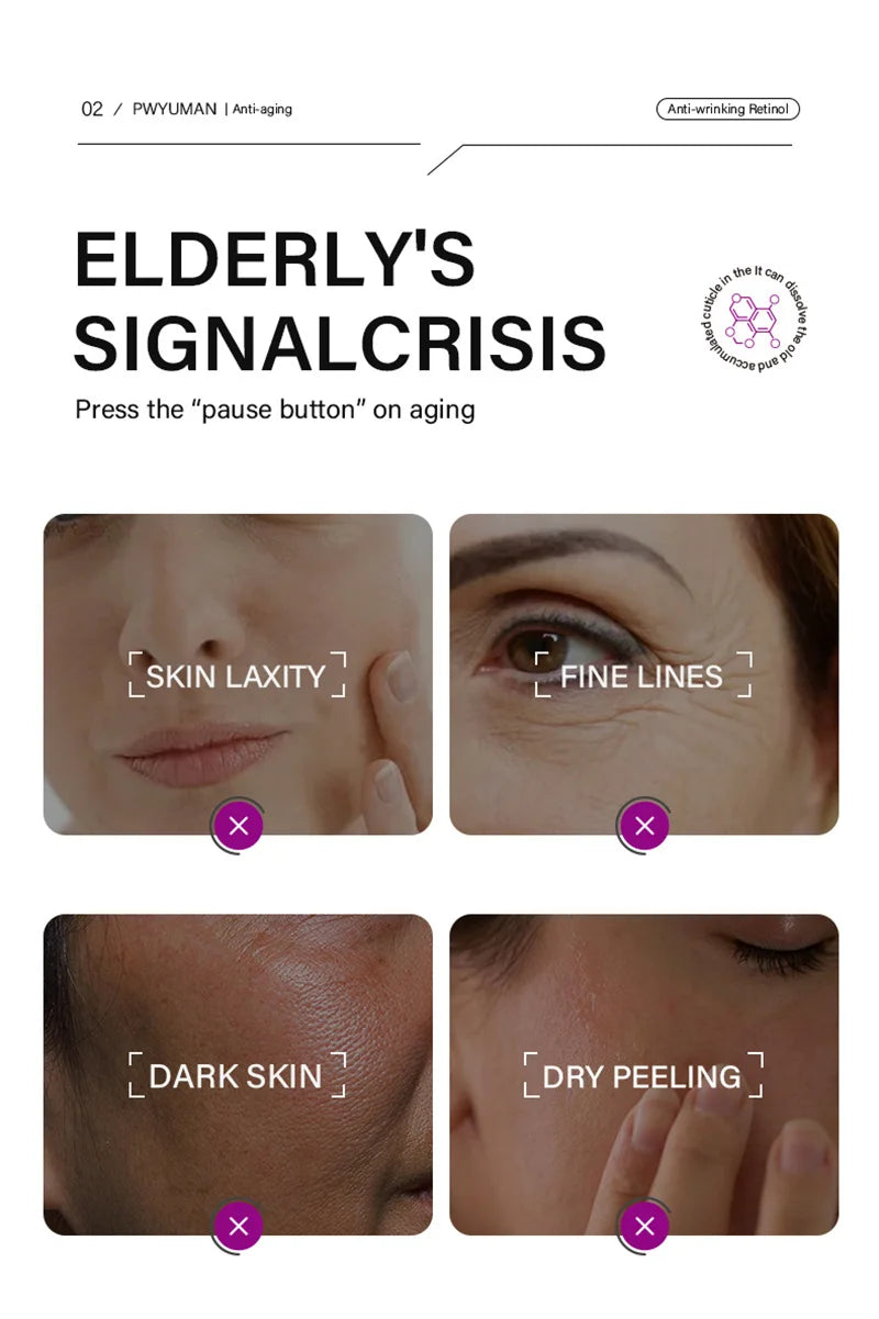 Retinol Against Wrinkles Serum Remove Wrinkle Firming Fade Fine Lines Anti Aging Improve Laugh Line Moisturizing Skin Care Korea