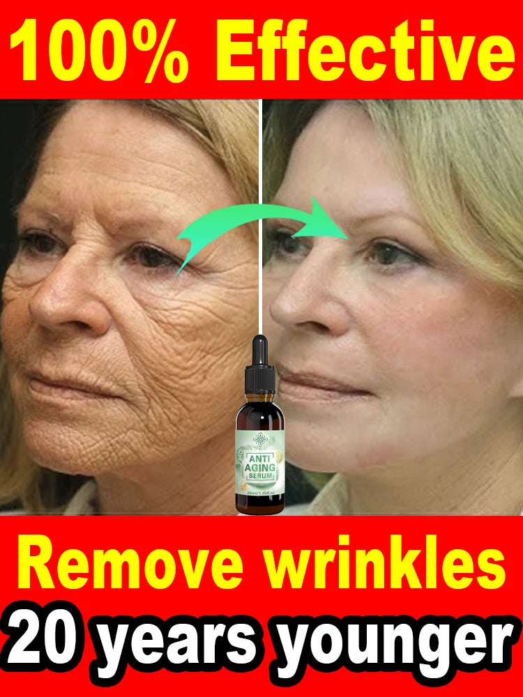 Wrinkles disappear