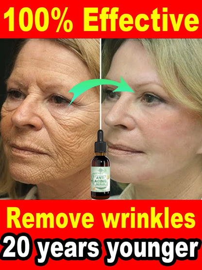 Wrinkles disappear