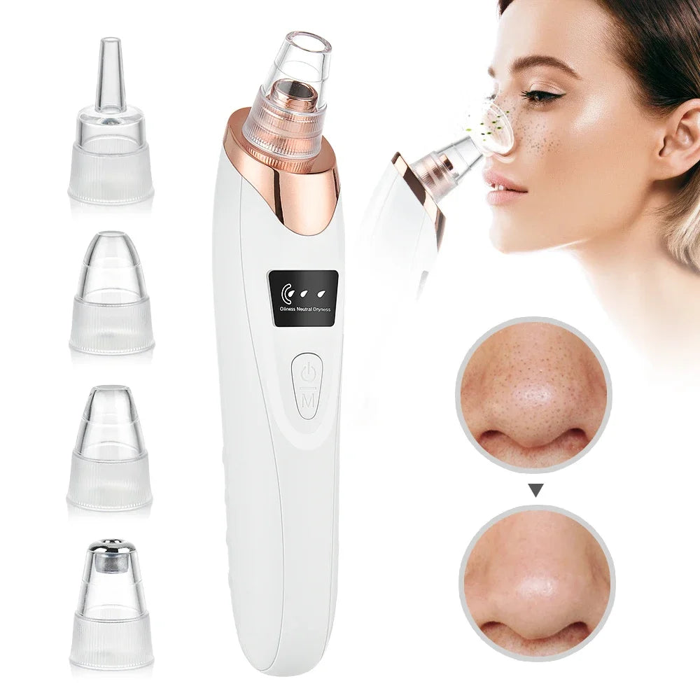 Okayso Blackhead Remover with Acne Needle Vacuum Pore Cleaner Black Pimple Blemish Remove for Face&Nose Skin Care Tool Kit