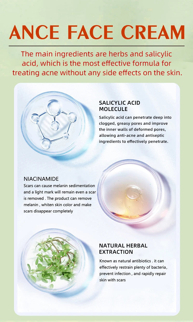 LUNDBORLY Acne Care Cream with Natural Herbal Extracts Helps Soothe Skin Improve Skin Texture and Keep Skin Smooth and Radiant