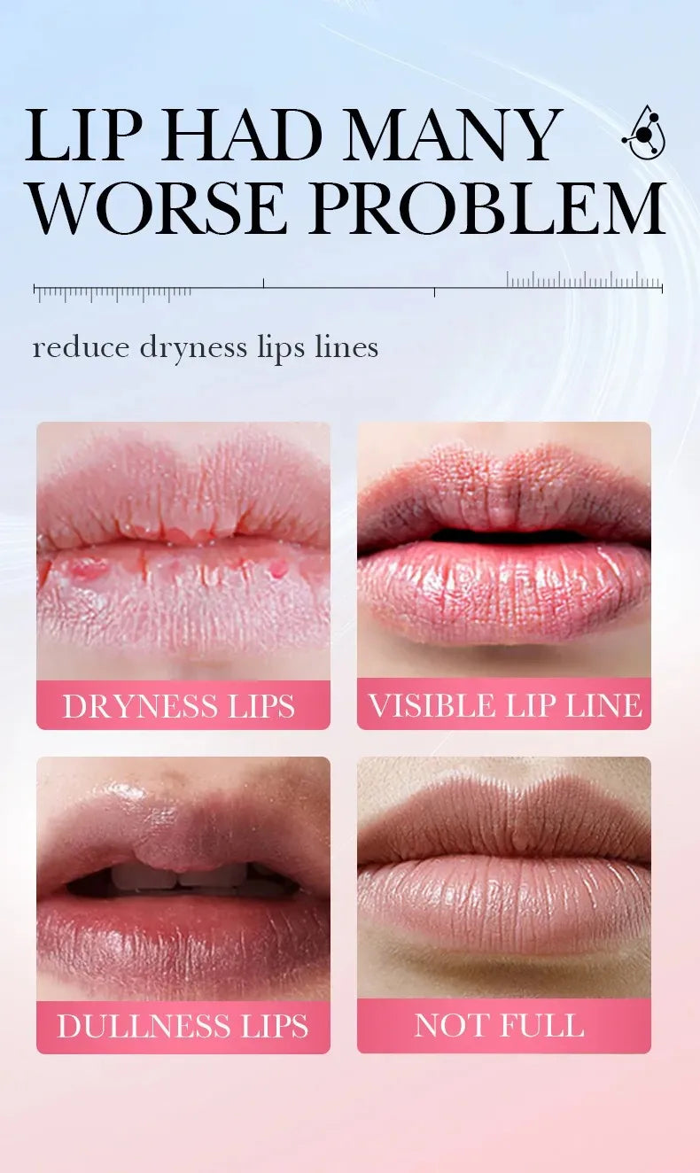 Exfoliating Lip Treatment Mask Gloss - Lightening Melanin Dark Lip Balm Remove Pink Moisturizing Reduce Lip Lines Improve Drynes